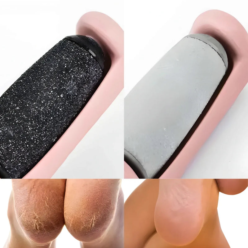 Raspador de Pé Eletrônico Calcanhar Remoção de Calos