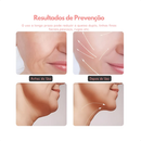 Massageador Facial Eletrico Pescoço Led Lift  Anti Rugas UBS